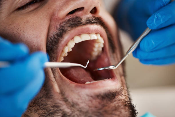 Best Emergency Broken Tooth Repair in Forsyth, GA