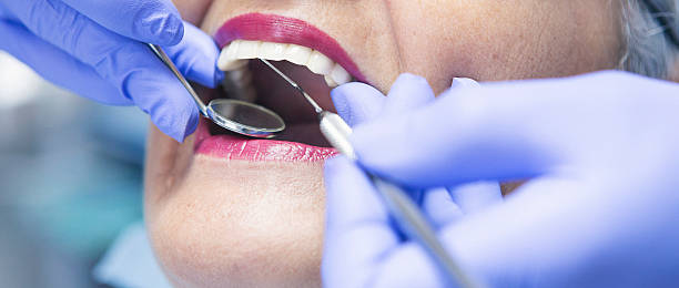Best Emergency Wisdom Teeth Removal in Forsyth, GA
